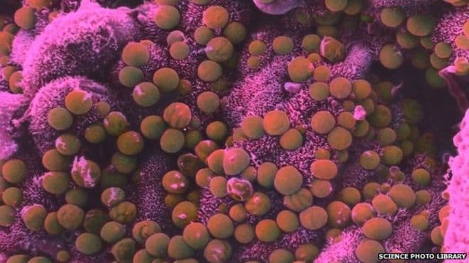 Step by Step Guide to Disinfect Your Water Well